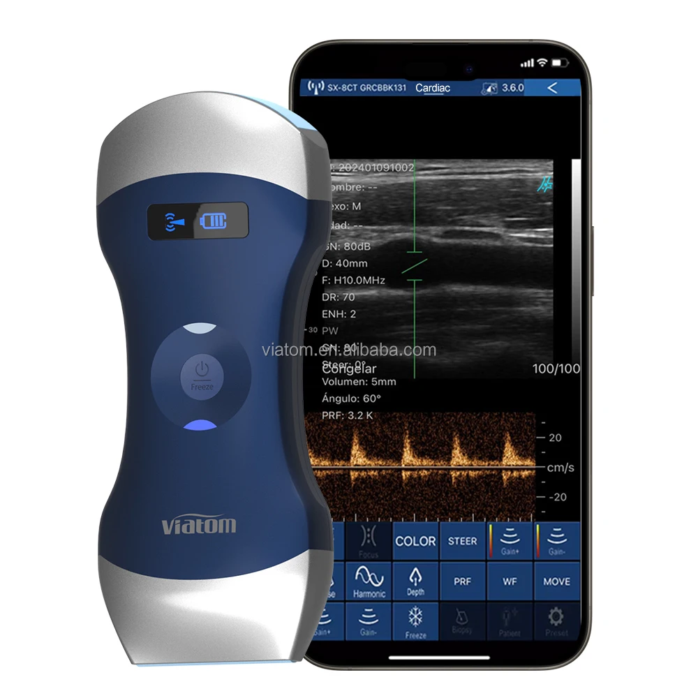Use Viatom Primary Care Ultrasound to Screen for Abdominal Aortic Aneurysms and Renal/Bladder Status
Use Viatom Primary Care Ultrasound to Screen for Abdominal Aortic Aneurysms and Renal/Bladder Status