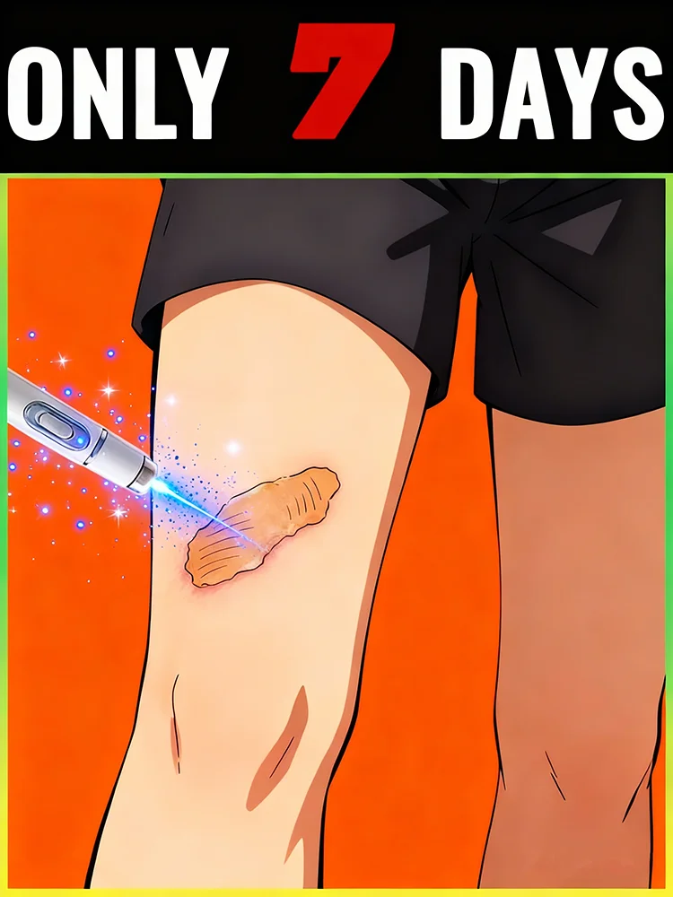 Tʜᴇ 2025 ʙᴇsᴛ-sᴇʟʟɪɴɢ ɴᴀɴᴏ-ʟᴇᴠᴇʟ ʙʟᴜᴇ ʟɪɢʜᴛ ᴘᴇɴ ᴄᴀɴ sᴏʟᴠᴇ ᴠᴀʀɪᴏᴜs ʙᴏᴅʏ sᴄᴀʀs
Tʜᴇ 2025 ʙᴇsᴛ-sᴇʟʟɪɴɢ ɴᴀɴᴏ-ʟᴇᴠᴇʟ ʙʟᴜᴇ ʟɪɢʜᴛ ᴘᴇɴ ᴄᴀɴ sᴏʟᴠᴇ ᴠᴀʀɪᴏᴜs ʙᴏᴅʏ sᴄᴀʀs