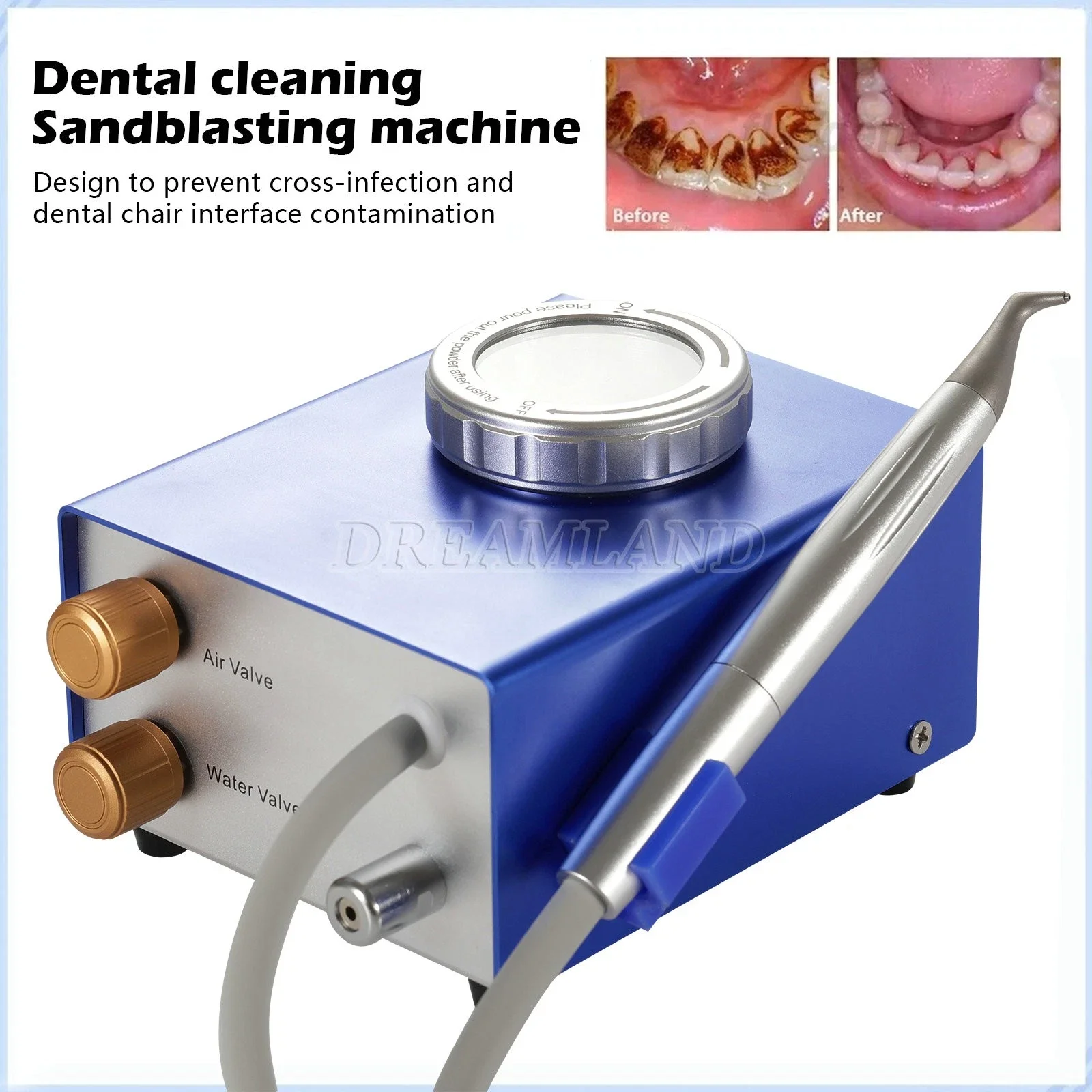Dental Sandblasting Machine Air Water Prophy Teeth Cleaning Whitening Polishing
Dental Sandblasting Machine Air Water Prophy Teeth Cleaning Whitening Polishing