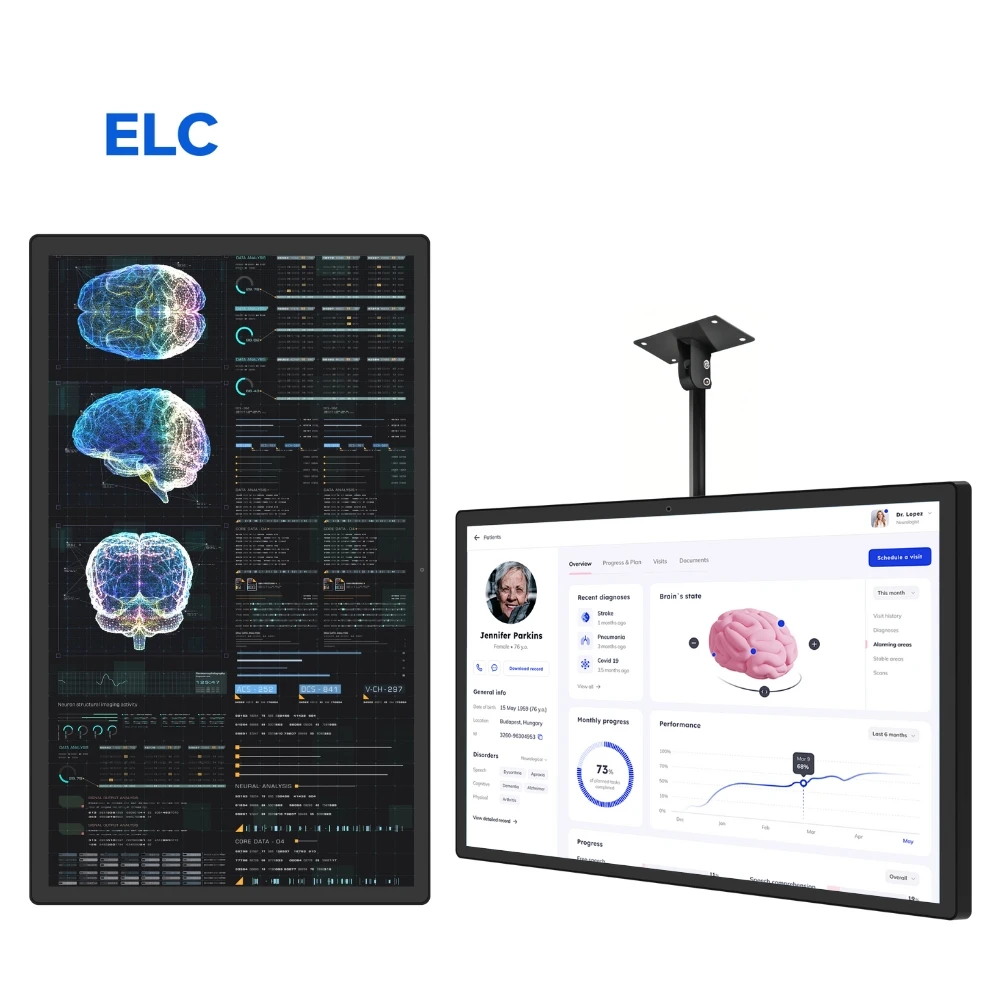 Ceiling Mount 27 32 43 55 Inch Hospital Hang Commercial Digital Signage Display Advertising Android 10 Tablet Lcd Panel
Ceiling Mount 27 32 43 55 Inch Hospital Hang Commercial Digital Signage Display Advertising Android 10 Tablet Lcd Panel
