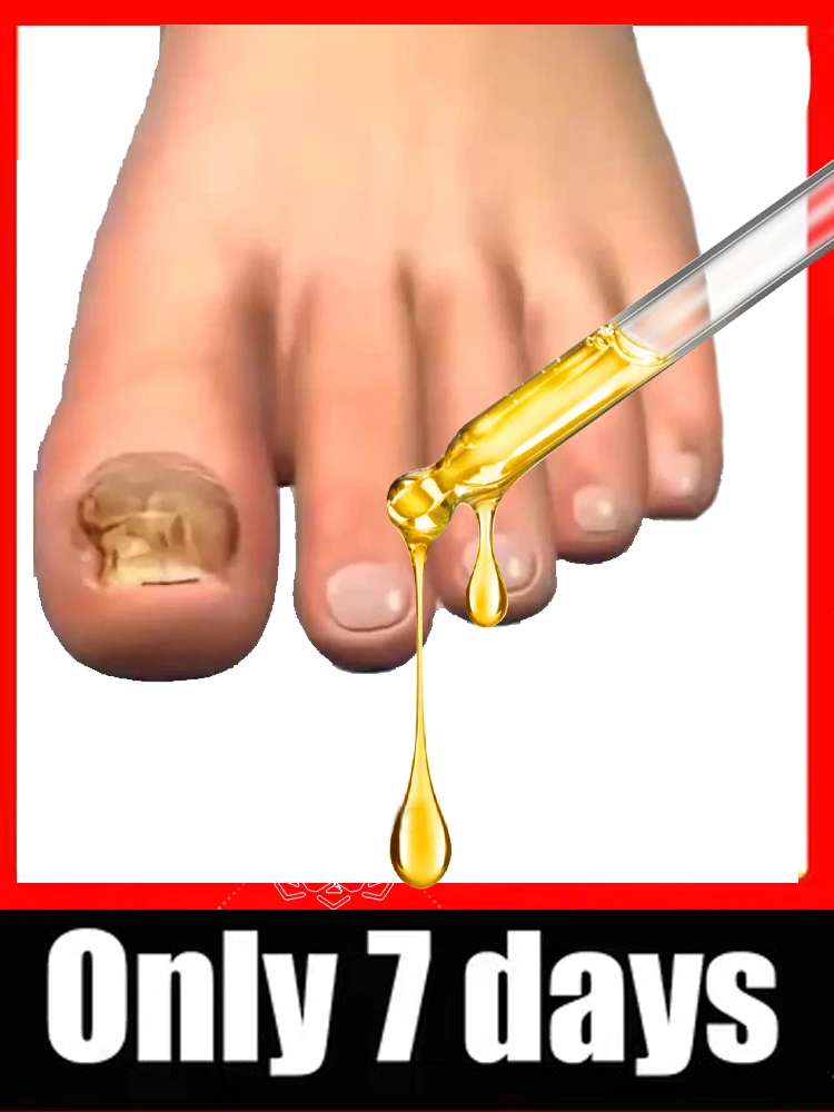 2025 Care Correction Tool Pedicure Professional Foot
2025 Care Correction Tool Pedicure Professional Foot