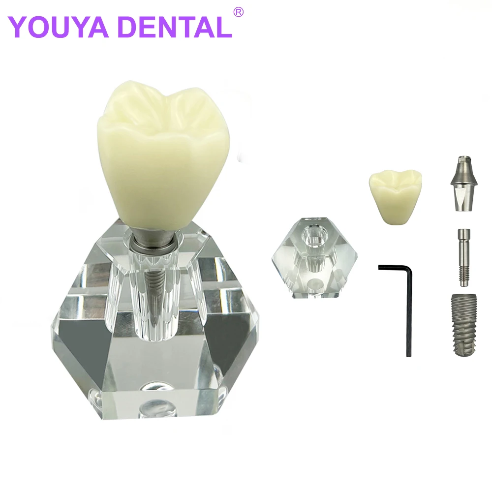 Dental Crystal Implant Tooth Model Teeth Adult Models Detachable Demonstration Dentistry Lab Study Teaching Material Dental Impl
Dental Crystal Implant Tooth Model Teeth Adult Models Detachable Demonstration Dentistry Lab Study Teaching Material Dental Impl