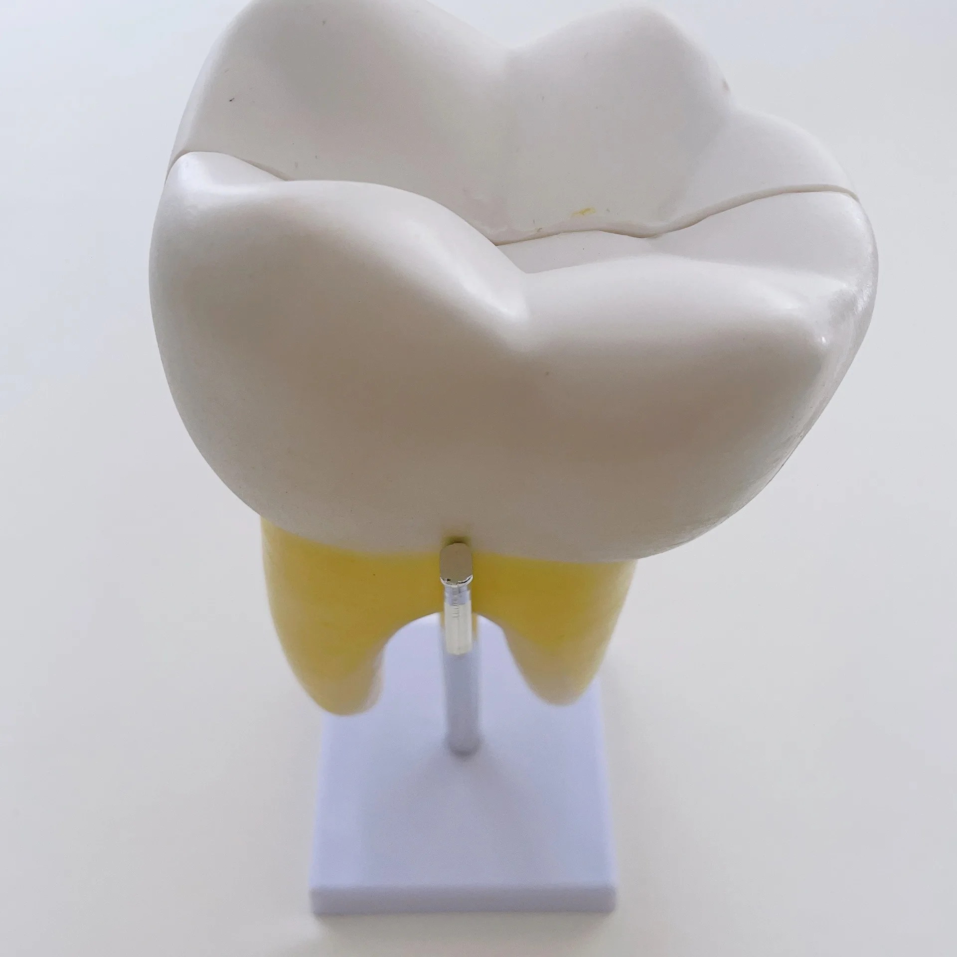 Human molar anatomy model Kindergarten dentals teaching aids 6 times large tooth anatomy model
Human molar anatomy model Kindergarten dentals teaching aids 6 times large tooth anatomy model