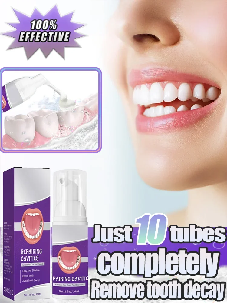 Reliable Dental paste Prevent Tooth Decay Dental Caries Whitening Teeth Fresh Breath Repair Tooth Decay
Reliable Dental paste Prevent Tooth Decay Dental Caries Whitening Teeth Fresh Breath Repair Tooth Decay