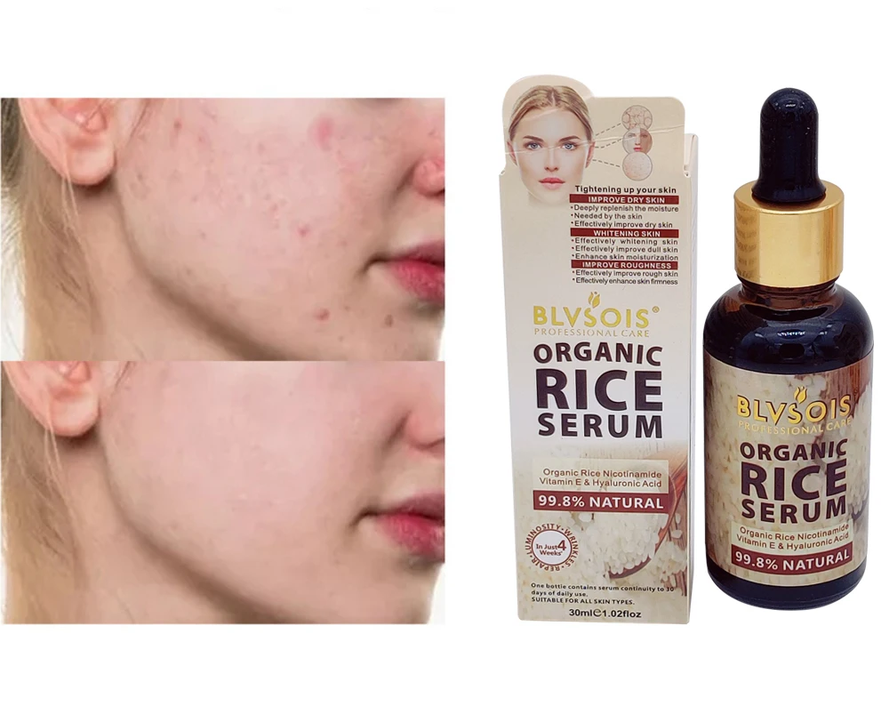 Foreign trade export face care essence mild and comfortable skin care dark face serum rice essence
Foreign trade export face care essence mild and comfortable skin care dark face serum rice essence