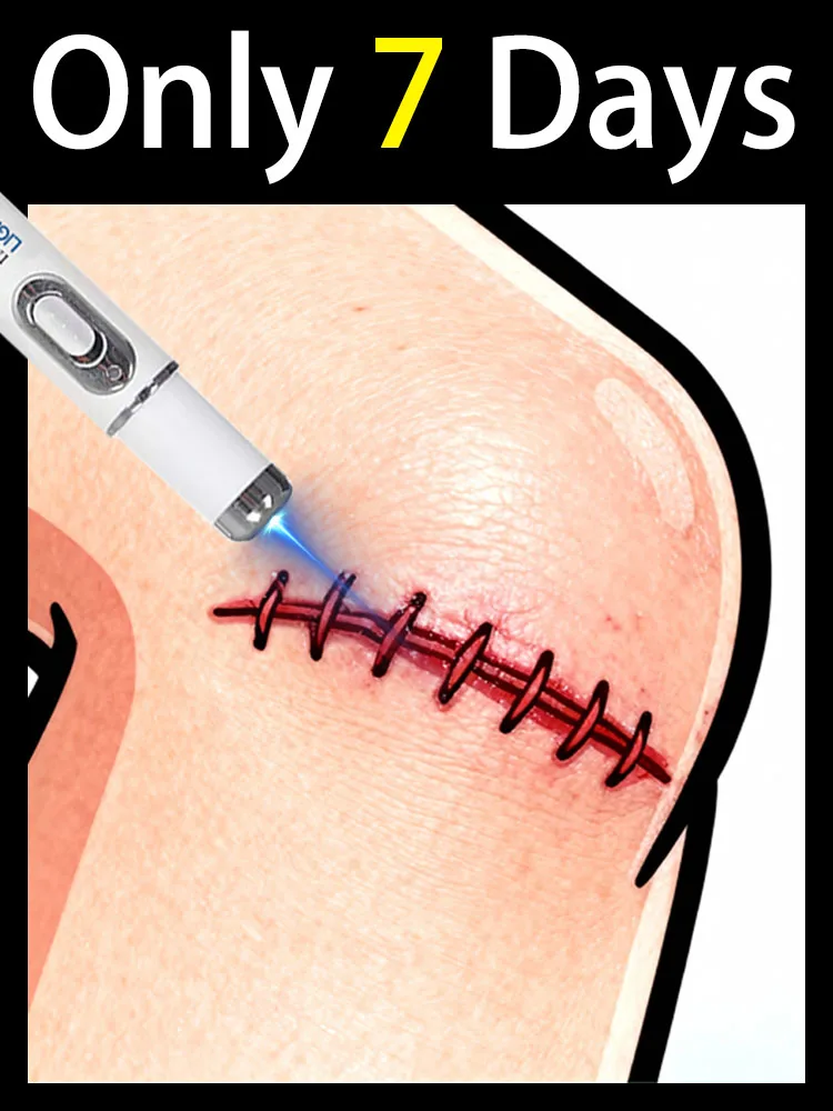 Для ухода за спиной, шеей, талией, ногами, коленей. Новое обновление помощи людям, которые самоуправляют от следов тела решают их проблемы, Unisexx.
Для ухода за спиной, шеей, талией, ногами, коленей. Новое обновление помощи людям, которые самоуправляют от следов тела решают их проблемы, Unisexx.