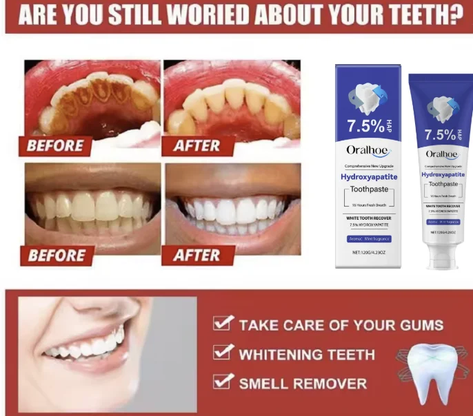 Hydroxyapatite Toothpaste Tooth Whiten Reduce Plaque Anti Decay Protect Teeth Dental Bleach Fresh Breath Gum Repair Toothpaste
Hydroxyapatite Toothpaste Tooth Whiten Reduce Plaque Anti Decay Protect Teeth Dental Bleach Fresh Breath Gum Repair Toothpaste