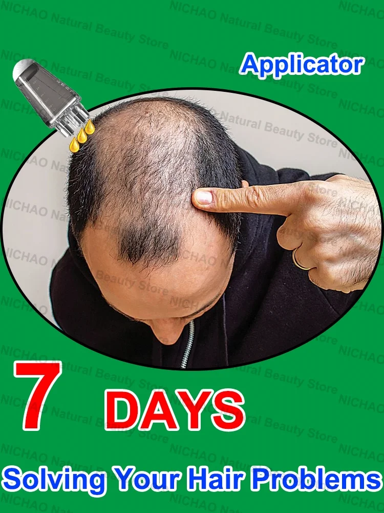 7 Days Fast Hair Growth Essential Loss Regrowth Treatment Strengthens Hair Nourishes Scalp Light Weight Non Greasy
7 Days Fast Hair Growth Essential Loss Regrowth Treatment Strengthens Hair Nourishes Scalp Light Weight Non Greasy