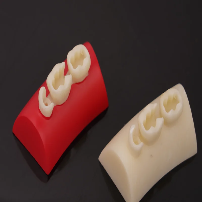 Oral Filling Model Dental Inlay Exercise Model Block Filling Exercise Typodont Resin Materials For Dentistry Teaching Stud Tools
Oral Filling Model Dental Inlay Exercise Model Block Filling Exercise Typodont Resin Materials For Dentistry Teaching Stud Tools