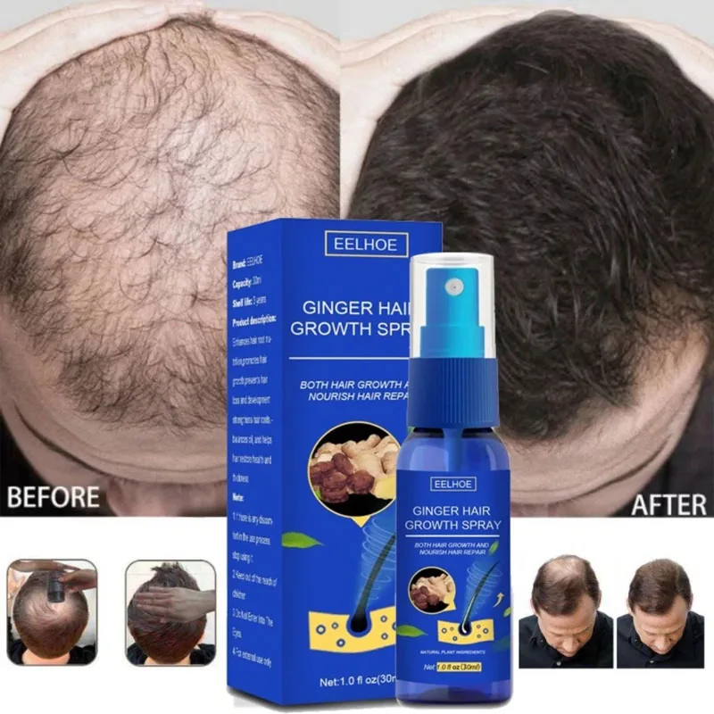 Ginger Hair Growth Serum Spray Anti Loss Regrowth Hair Growth Oil Essence Scalp Massage Moisturizing Nourish Hair Care Men Women
Ginger Hair Growth Serum Spray Anti Loss Regrowth Hair Growth Oil Essence Scalp Massage Moisturizing Nourish Hair Care Men Women