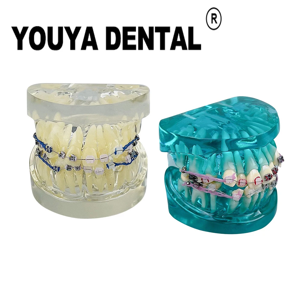 Teeth Model Dental Orthodontic Model for Dentist Technician Dental Teaching Studying Doctor-patient Communication
Teeth Model Dental Orthodontic Model for Dentist Technician Dental Teaching Studying Doctor-patient Communication