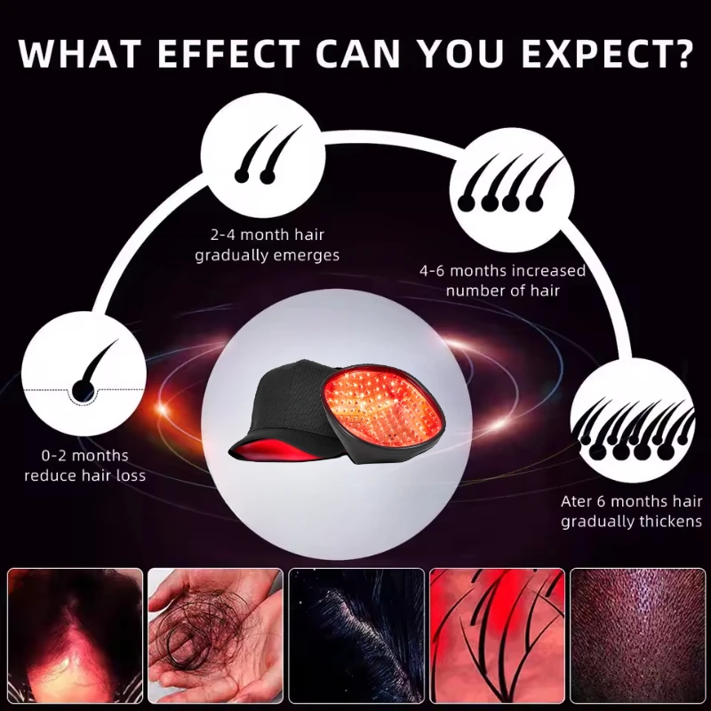 Professional 96 Laser Hair Growth Cap LLLT Therapy Hair Loss Treatment for Androgenetic Alopecia Laser Cap Superior Coverage
Professional 96 Laser Hair Growth Cap LLLT Therapy Hair Loss Treatment for Androgenetic Alopecia Laser Cap Superior Coverage