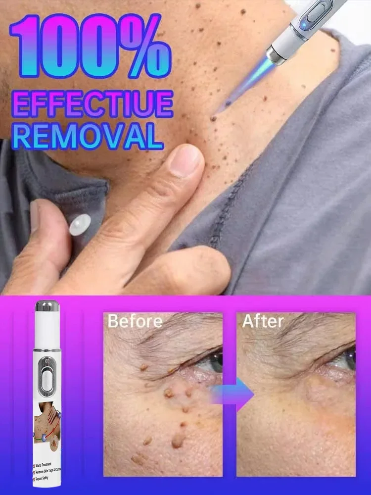 2025 hot Skin care pen, smooth body facial skin Keyou clean skin convenient operation care pen
2025 hot Skin care pen, smooth body facial skin Keyou clean skin convenient operation care pen