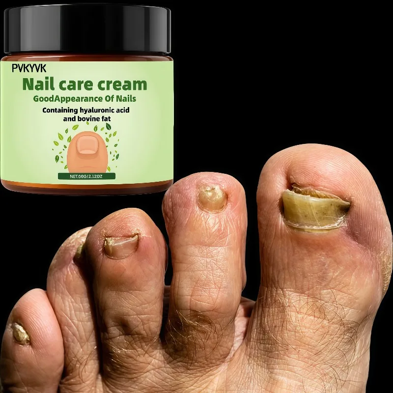 Крем для ногтей, подходящий для ухода за сухими, грубыми и ломкими ногтями, содержит мочевину, витамин С и гиалуроновую кислоту, питающий кожу рук.
Крем для ногтей, подходящий для ухода за сухими, грубыми и ломкими ногтями, содержит мочевину, витамин С и гиалуроновую кислоту, питающий кожу рук.