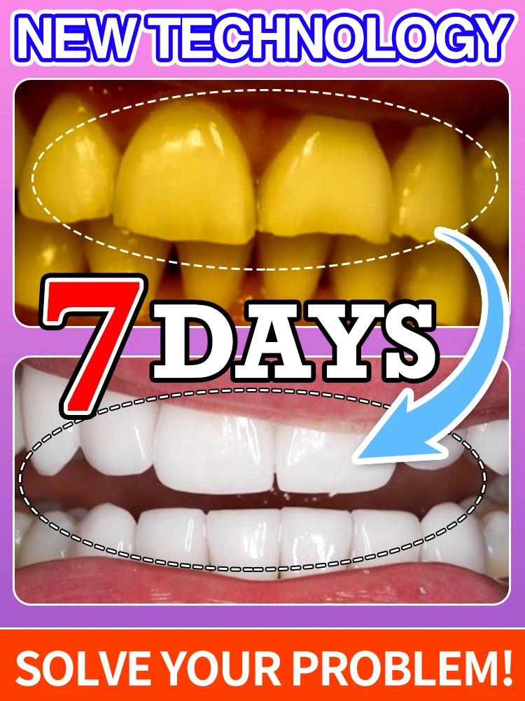 Dental calculus remove Sensitive Teeth Whitening Mousse Fast Whitening Safe and Non-Irritating Removing dental plaque
Dental calculus remove Sensitive Teeth Whitening Mousse Fast Whitening Safe and Non-Irritating Removing dental plaque