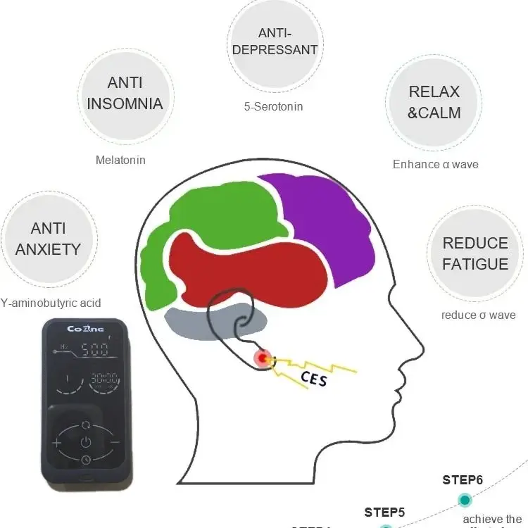 Медицинский CES-клип для ушей, стимулятор электротерапии черепа для лечения бессонницы, облегчения боли в голове
Медицинский CES-клип для ушей, стимулятор электротерапии черепа для лечения бессонницы, облегчения боли в голове