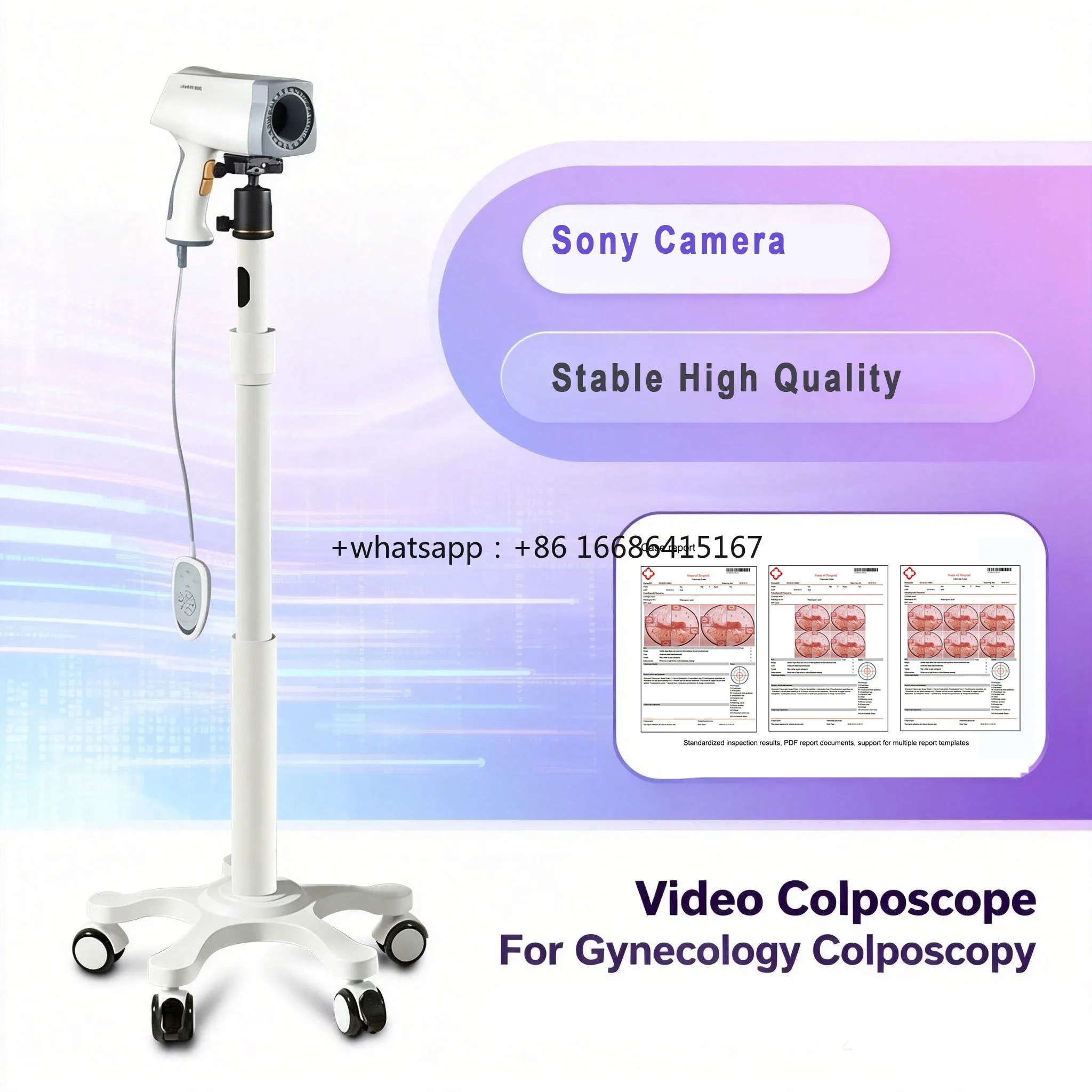 Kernel Brand Hd Video Digital Magnification With LED Illumination KN-2200 High Quality At A Great Price
Kernel Brand Hd Video Digital Magnification With LED Illumination KN-2200 High Quality At A Great Price
