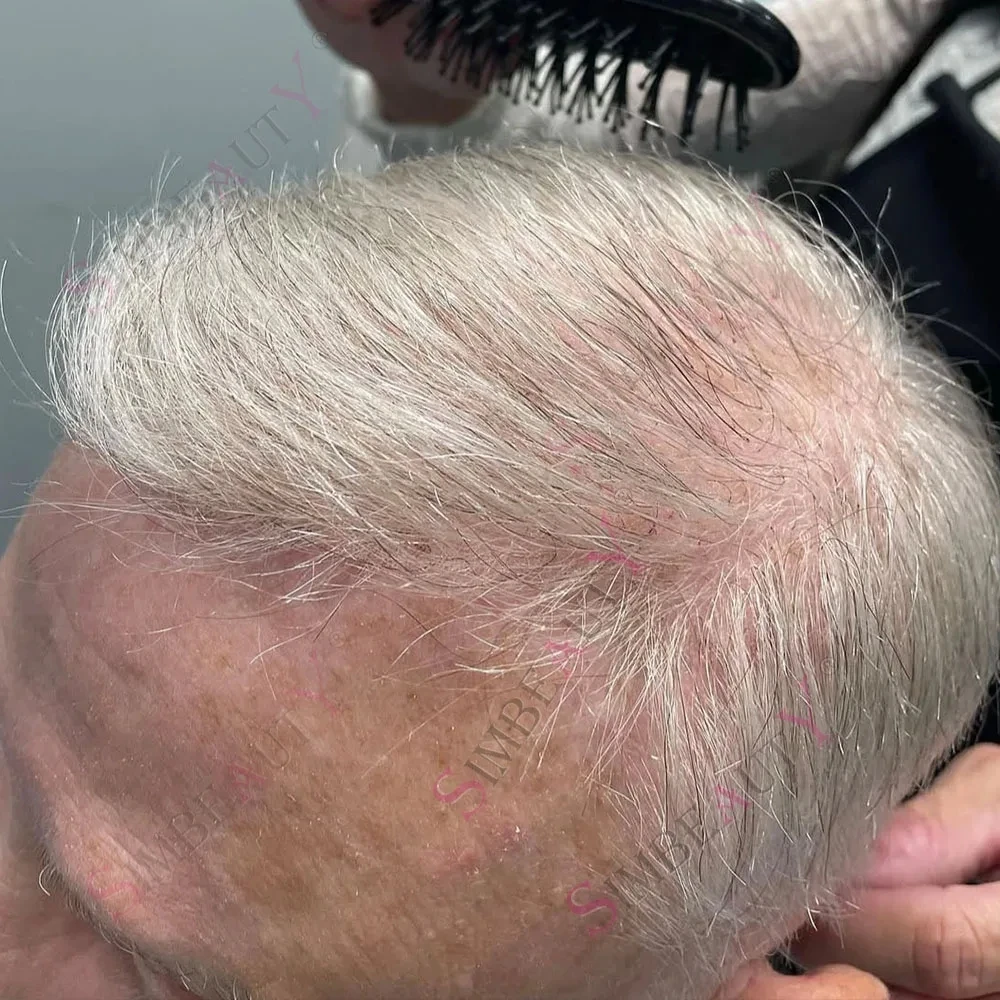 Натуральная линия волос1B80 1B65 Серый мужской парик 0,02 мм Ультратонкая кожа VLoop 80% Плотность Мужской парик Человеческие волосы Капиллярный протез
Натуральная линия волос1B80 1B65 Серый мужской парик 0,02 мм Ультратонкая кожа VLoop 80% Плотность Мужской парик Человеческие волосы Капиллярный протез