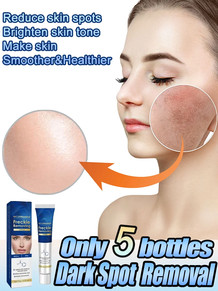 Melanin-Removing Serum Whitening Fading Age Spots Chloasma Freckles Brightening Moisturizing And Repairing Facial Essence
Melanin-Removing Serum Whitening Fading Age Spots Chloasma Freckles Brightening Moisturizing And Repairing Facial Essence