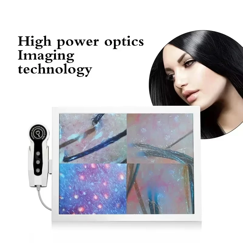 15 Inch HD Display Professional Hair Follicle Detector 50/200X Scalp Diagnostic Machine Skin Analyzer Oil Moisture Tester for Be
15 Inch HD Display Professional Hair Follicle Detector 50/200X Scalp Diagnostic Machine Skin Analyzer Oil Moisture Tester for Be