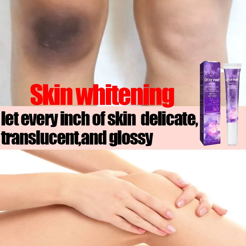 Skin Whitening Cream Private Parts Lightening Whitening Cream for Dark Skin Arm Thigh Body Knees Whitening Brighten Skin Mild
Skin Whitening Cream Private Parts Lightening Whitening Cream for Dark Skin Arm Thigh Body Knees Whitening Brighten Skin Mild