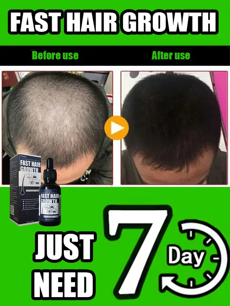 Clinically Tested for Thicker Hair | Hair strengthening Treatment | Hair Growth Supplements
Clinically Tested for Thicker Hair | Hair strengthening Treatment | Hair Growth Supplements