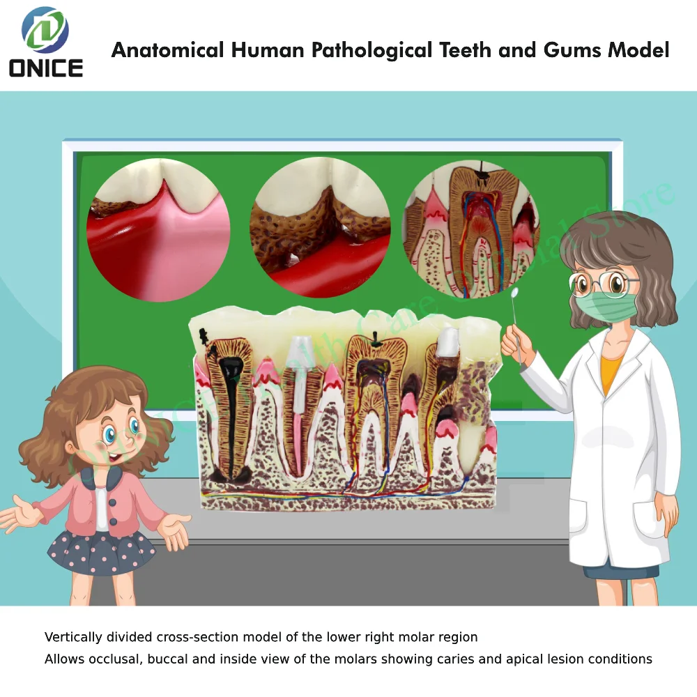 Comprehensive Anatomical Dental Pathology Model: Visualizing Common Tooth & Gum Diseases for Medical Education & Training
Comprehensive Anatomical Dental Pathology Model: Visualizing Common Tooth & Gum Diseases for Medical Education & Training