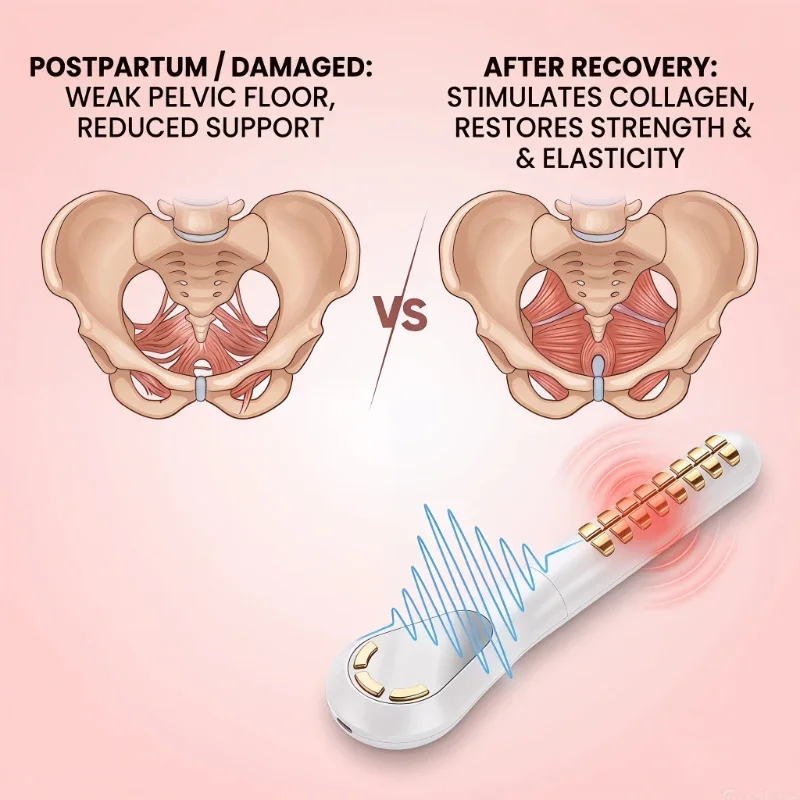 Gynecologist Approved Red Light Therapy Device for Pelvic Floor Rehabilitation Enhances Vaginal Tightness And Treats Vaginal Inf
Gynecologist Approved Red Light Therapy Device for Pelvic Floor Rehabilitation Enhances Vaginal Tightness And Treats Vaginal Inf