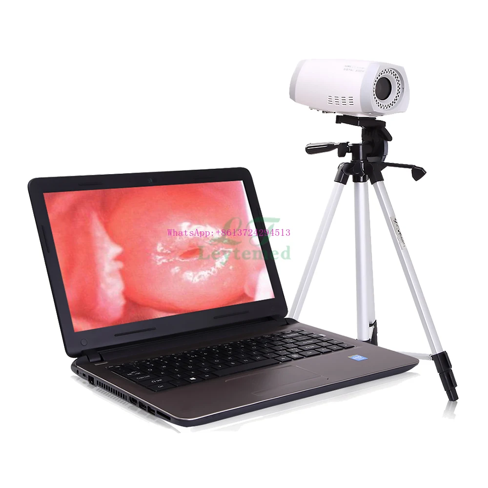 Professional medical equipment LTEC02 portable medical used digital colposcope
Professional medical equipment LTEC02 portable medical used digital colposcope