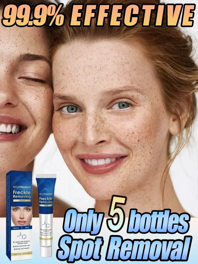 Effictive Dark Spot Remover cream for Face Removing Freckle Melasma Chloasma Senile Plaques Sunburn Cyasma Chorioplaque Freckle
Effictive Dark Spot Remover cream for Face Removing Freckle Melasma Chloasma Senile Plaques Sunburn Cyasma Chorioplaque Freckle