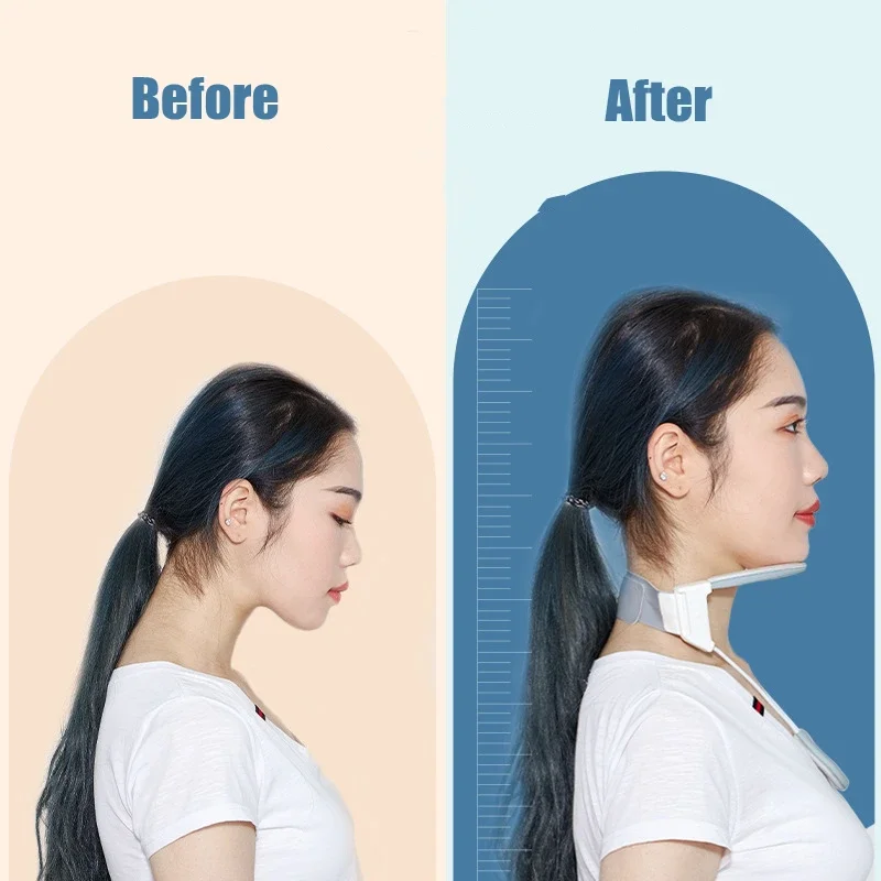 NECK Helper Braces Pain Lightweight ,Supports Improving Forward Head Posture with heat Discreet Comfortable Cervical Collar
NECK Helper Braces Pain Lightweight ,Supports Improving Forward Head Posture with heat Discreet Comfortable Cervical Collar