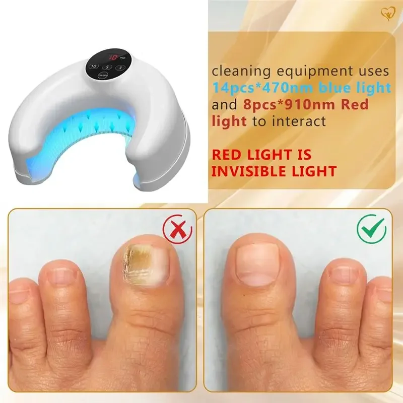 B67A Wireless Nail Fungus Laser Device Anti Infection Paronychia Onychomycosis Grow Toe Nail 14Pcs 470Nm Blue Light Toenails
B67A Wireless Nail Fungus Laser Device Anti Infection Paronychia Onychomycosis Grow Toe Nail 14Pcs 470Nm Blue Light Toenails