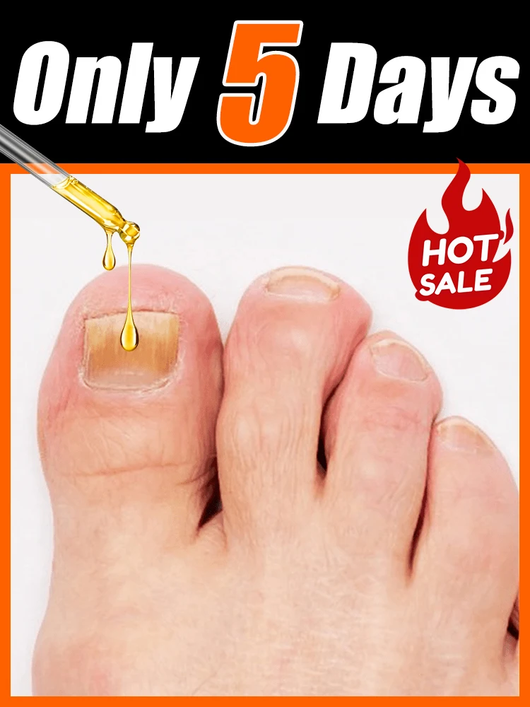 2025 Toenail Fungus Patch Waterproof Nail Repair Patches Nail Ingrown Correction Sticker Discolored Damaged Nail Foot Care Tool
2025 Toenail Fungus Patch Waterproof Nail Repair Patches Nail Ingrown Correction Sticker Discolored Damaged Nail Foot Care Tool