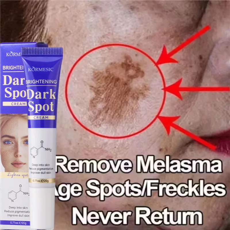 Dark Spots Removal Cream Facial Whitening Freckle Acne Mark Pigmentation Removal Melanin Skin Correction Brighten Care Products
Dark Spots Removal Cream Facial Whitening Freckle Acne Mark Pigmentation Removal Melanin Skin Correction Brighten Care Products