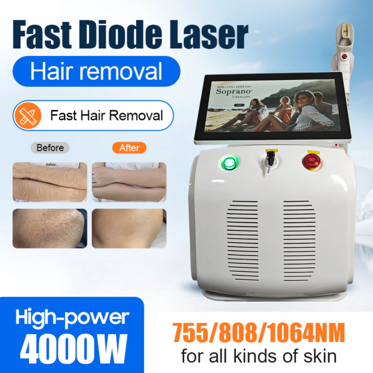 4000w High Power Diode Laser Depilacion Laser Hair Removal Ice Titanium Painless Hair Removal Diode Laser Epilation Machine
4000w High Power Diode Laser Depilacion Laser Hair Removal Ice Titanium Painless Hair Removal Diode Laser Epilation Machine