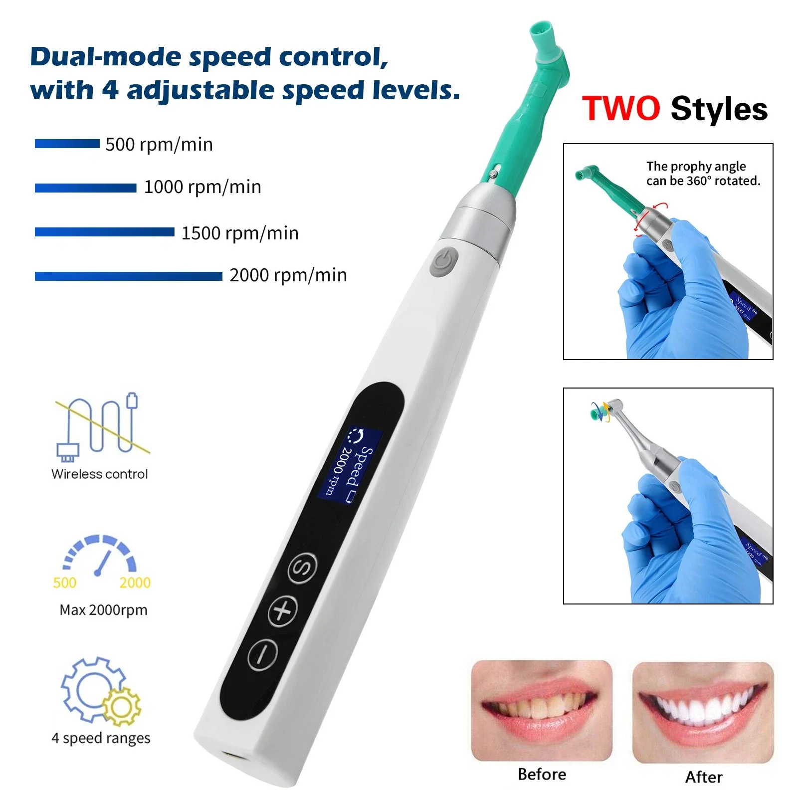 Dental Electric Wireless Hygiene Prophy Polishing Handpiece 360° Swivel Polisher
Dental Electric Wireless Hygiene Prophy Polishing Handpiece 360° Swivel Polisher