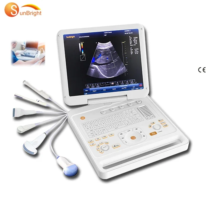 Ecografia SUN-906B Vet Ultrasound Portable Instruments Animals Ultrasound Machine
Ecografia SUN-906B Vet Ultrasound Portable Instruments Animals Ultrasound Machine