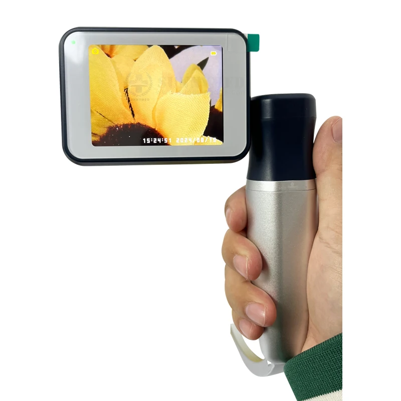 SY-P020D Disposable HD Endoscopic Laryngoscope Camera Module Single Use Laryngoscope Blades For Visual Laryngoscopy
SY-P020D Disposable HD Endoscopic Laryngoscope Camera Module Single Use Laryngoscope Blades For Visual Laryngoscopy