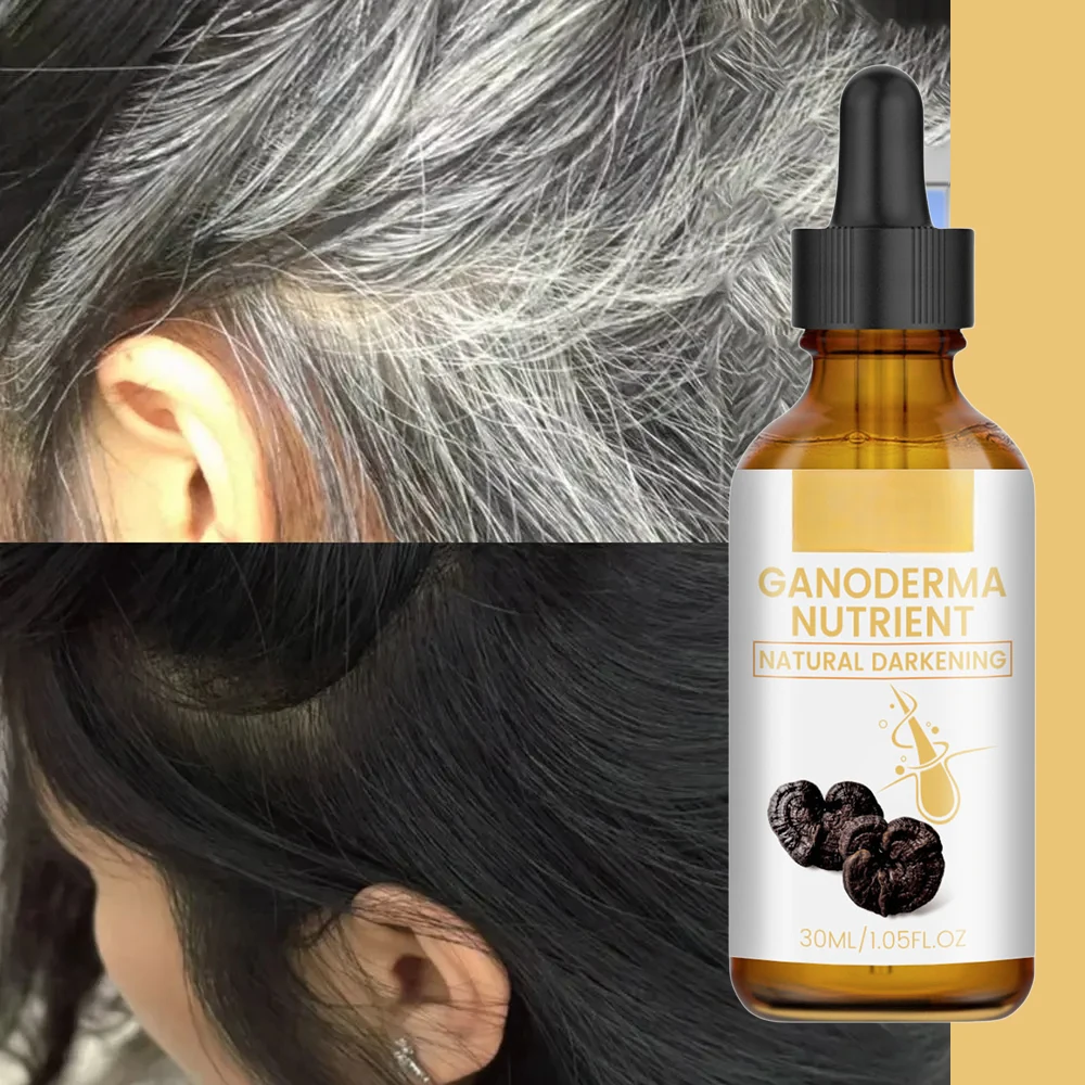 Magic White Hair To Black White Hair Killer, Remove Gray Hair and Restore Natural Hair1 Color in 7 Days
Magic White Hair To Black White Hair Killer, Remove Gray Hair and Restore Natural Hair1 Color in 7 Days