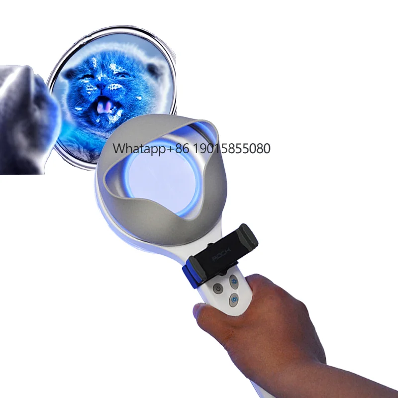 CE Approved Portable Dermoscope Medical Veterinary Woods Lamp Analyzer for Vitiligo Psoriasis test
CE Approved Portable Dermoscope Medical Veterinary Woods Lamp Analyzer for Vitiligo Psoriasis test