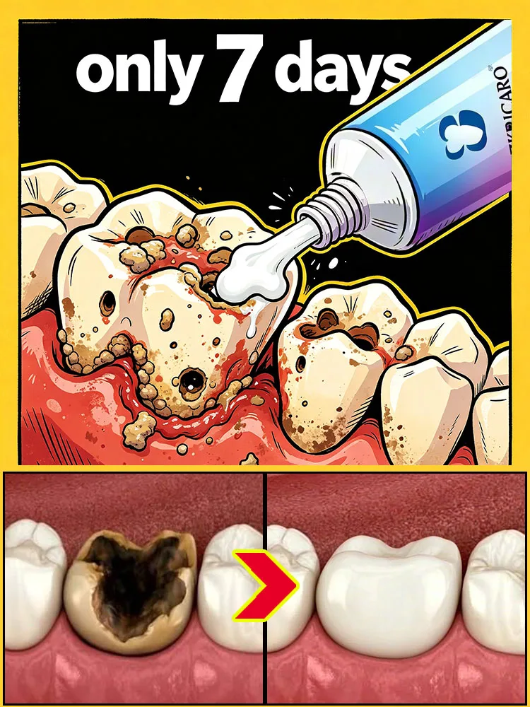 POZOAMIS Removes Tartar toothpaste Cavities Disappearance Cleans The Mouth Freshens Breath Whitens Teeth Gum Care Accessories Suitable For Home Use
POZOAMIS Removes Tartar toothpaste Cavities Disappearance Cleans The Mouth Freshens Breath Whitens Teeth Gum Care Accessories Suitable For Home Use