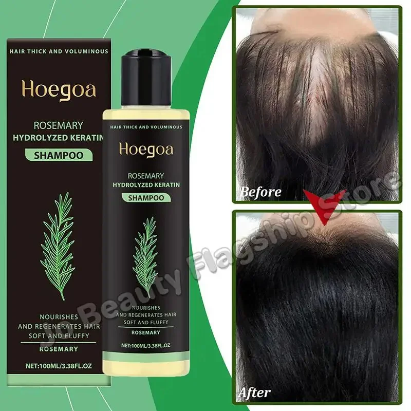 Organic Rosemary Hair Growth Shampoo Natural Thickening Strengthening Shampoo with Hydrolyzed Keratin Thinning Hair Hair Loss
Organic Rosemary Hair Growth Shampoo Natural Thickening Strengthening Shampoo with Hydrolyzed Keratin Thinning Hair Hair Loss