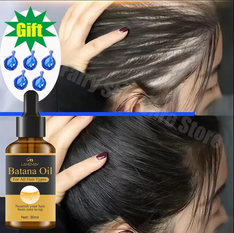 7 Days Fast Batana Oil Hair Growth Serum Anti-loss Hair Regrowth Products Repair Damaged Hair Roots Hair Care For Women Men
7 Days Fast Batana Oil Hair Growth Serum Anti-loss Hair Regrowth Products Repair Damaged Hair Roots Hair Care For Women Men