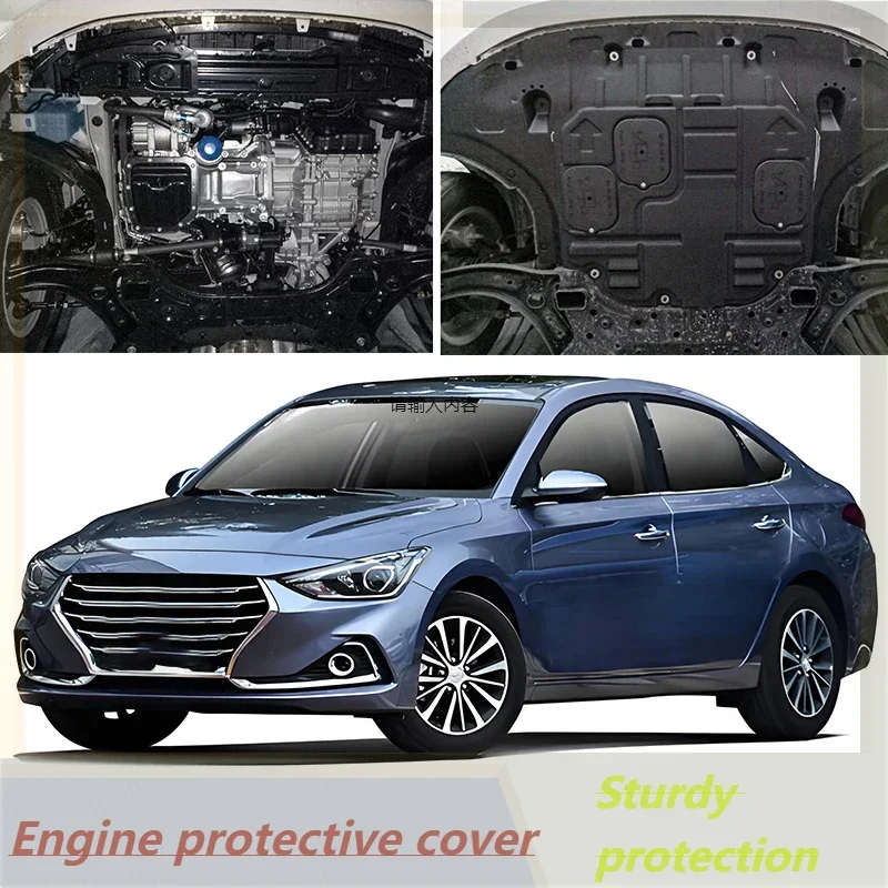 Vehicle - Specific Splash - Proof Durable Sturdy Engine Undercover And Lower Mudguard For Hyundai Celesta 2017-2020 1.6L
Vehicle - Specific Splash - Proof Durable Sturdy Engine Undercover And Lower Mudguard For Hyundai Celesta 2017-2020 1.6L