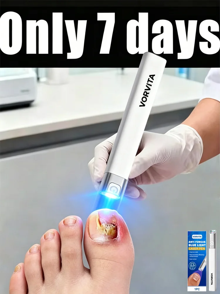 Nail Fungus Treatment Laser Pen Homeopathic Medicine Care Tool for Onychomycosis - Professional Grade Fungal Infection Remedy
Nail Fungus Treatment Laser Pen Homeopathic Medicine Care Tool for Onychomycosis - Professional Grade Fungal Infection Remedy