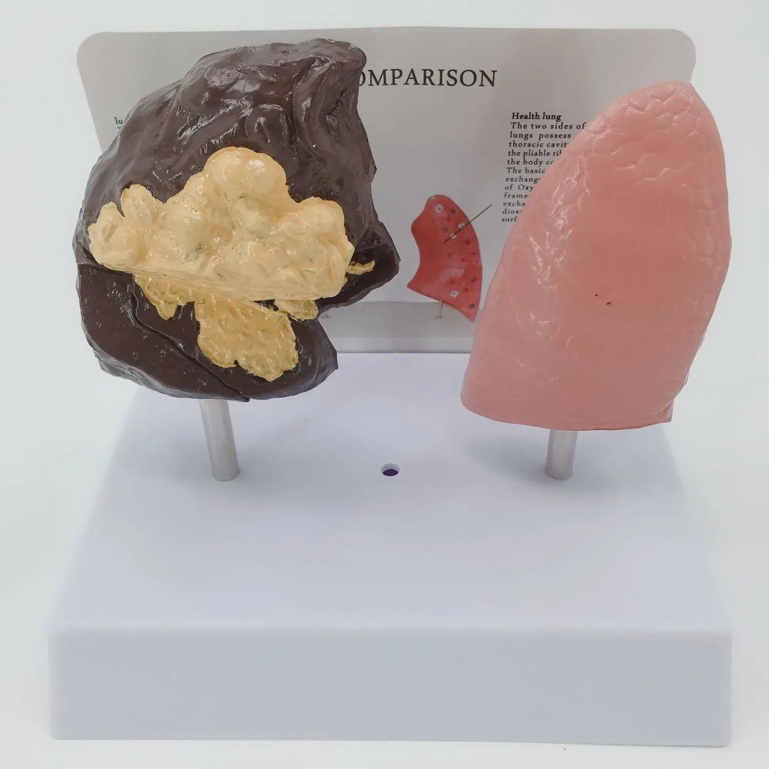Diseased Lung Model, Human Lung Anatomy Model, Smoker Visceral Model, Respiratory System, Pathological Lung Anatomy
Diseased Lung Model, Human Lung Anatomy Model, Smoker Visceral Model, Respiratory System, Pathological Lung Anatomy