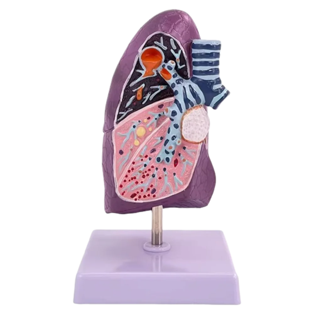 Lung Pathological Anatomical Model for Medical Science PVC Material Medical School Use
Lung Pathological Anatomical Model for Medical Science PVC Material Medical School Use