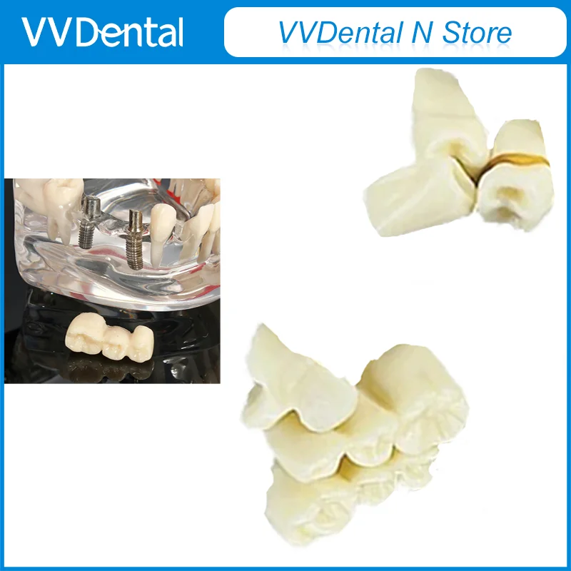 Removable Teeth Model Implant Disease Dentist Studying New Dental Model Teeth Implant Restoration Bridge Teaching Demonstration
Removable Teeth Model Implant Disease Dentist Studying New Dental Model Teeth Implant Restoration Bridge Teaching Demonstration