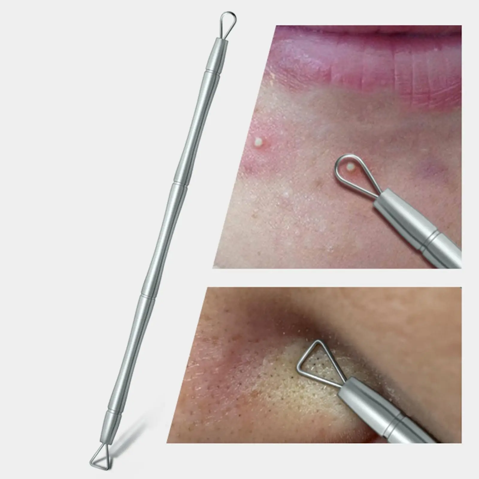 Stainless Steel Blackhead Tool Set Double Ended Comedone Extractor Needle Kit for Facial
Stainless Steel Blackhead Tool Set Double Ended Comedone Extractor Needle Kit for Facial