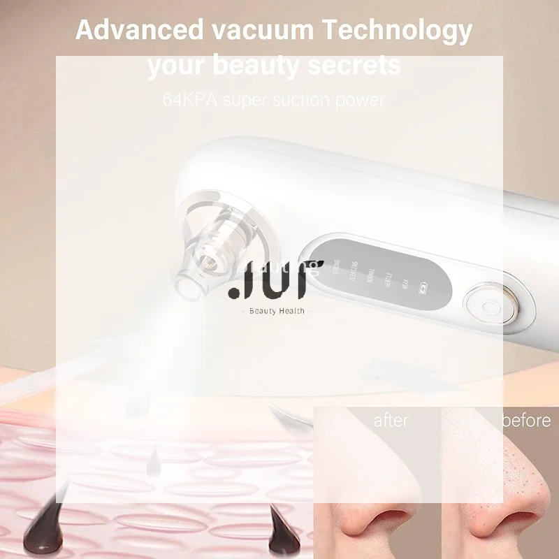 Electric Blackhead Remover Vacuum With Adjustable Suction Levels USB Rechargeable Perfect For Home Daily Facial Skincare
Electric Blackhead Remover Vacuum With Adjustable Suction Levels USB Rechargeable Perfect For Home Daily Facial Skincare